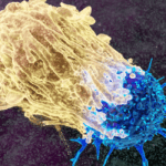 ZIRCON-X Çalışması ve Böbrek Kanserinde Tanısal Devrim