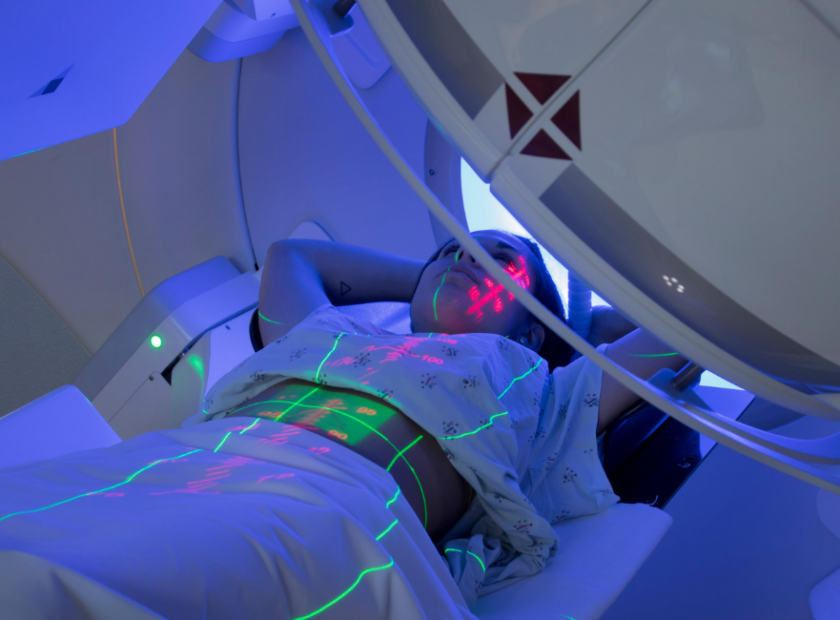 bobrek kanseri radyoterapi 840x620